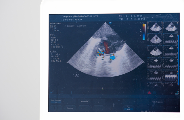 УЗДГ - что это такое? Показания к назначению