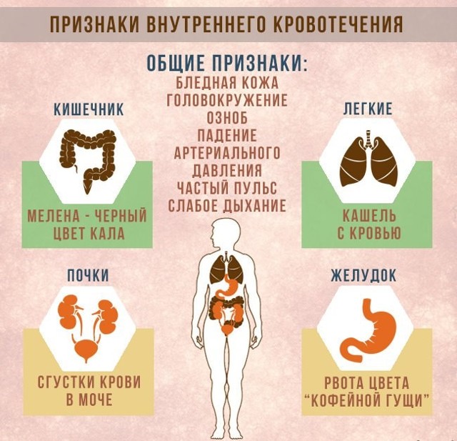 Виды кровотечений и оказание первой помощи
