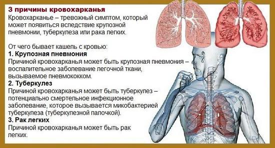 Кашель с кровью - что это может быть