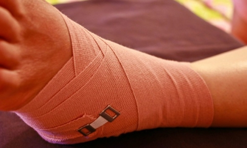 Синдром длительного раздавливания (СДР)