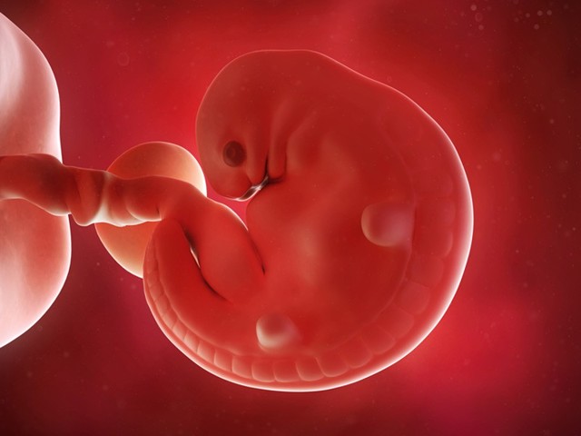 Идиопатическая тромбоцитопеническая пурпура.