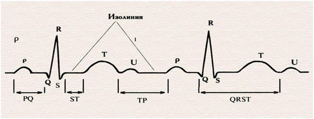 Регулярный и нерегулярный синусовый ритм сердца