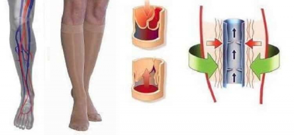 Компрессионный трикотаж. Советы и рекомендации.