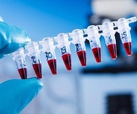 Anti hcv подтверждающий положительный что это значит — Лечим печень