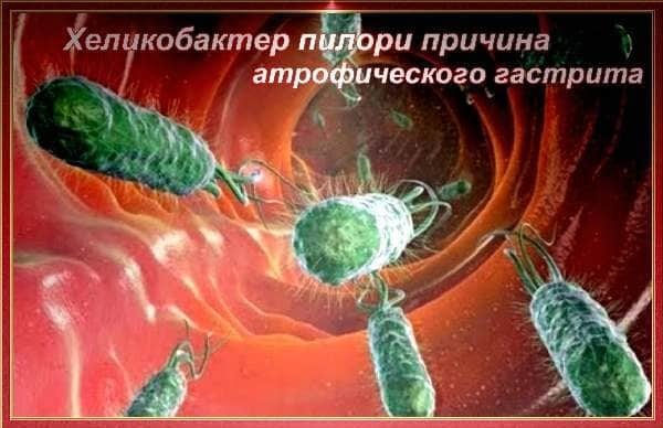 Хронический атрофический гастрит симптомы и лечение у взрослых