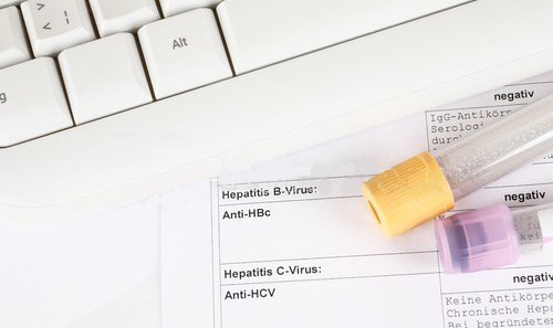 Anti hcv total что может повлиять. Способы обнаружения вируса. HCV крови: что это такое