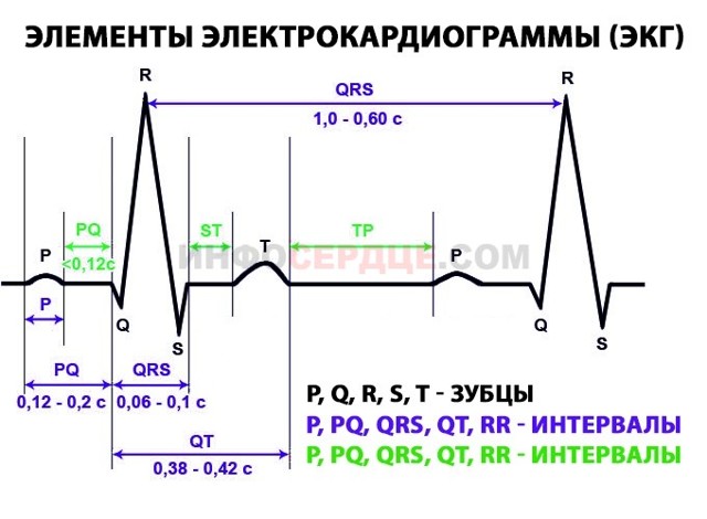 Синусовый ритм сердца: что это, ЭКГ, нарушения ритма