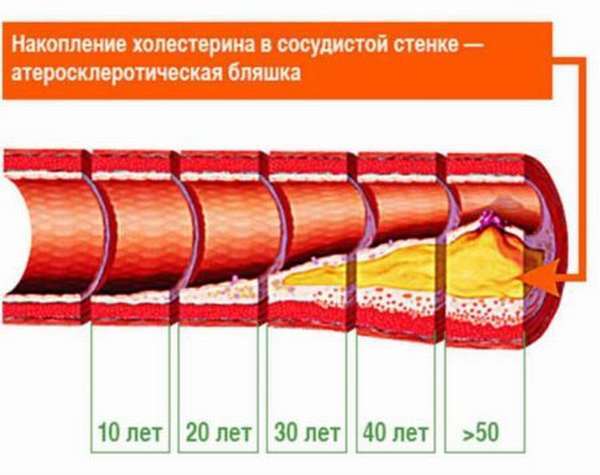 Холестерин 4 8 - Про холестерин