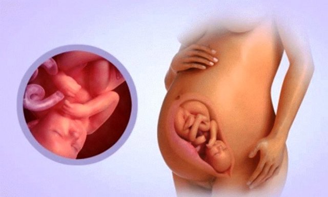 Геморрой при беременности - признаки, симптомы, причины и лечение