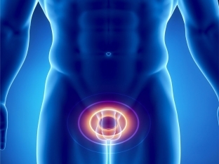 Застой в малом тазу у мужчин симптомы. Венозный застой крови в малом тазу и его последствия