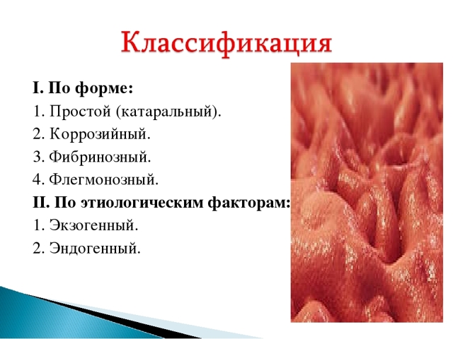 Катаральный гастрит - симптомы и лечение заболевания