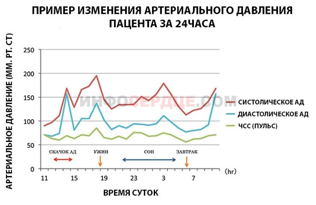 Смад показывает pause - средства, таблица, фото, что это