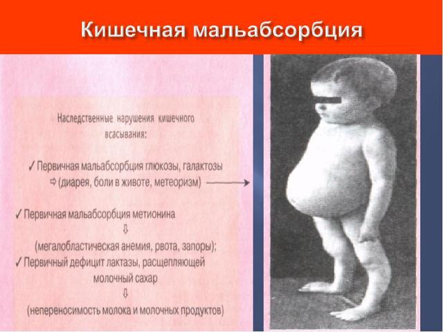 Карсил таблетки: инструкция по применению, аналоги