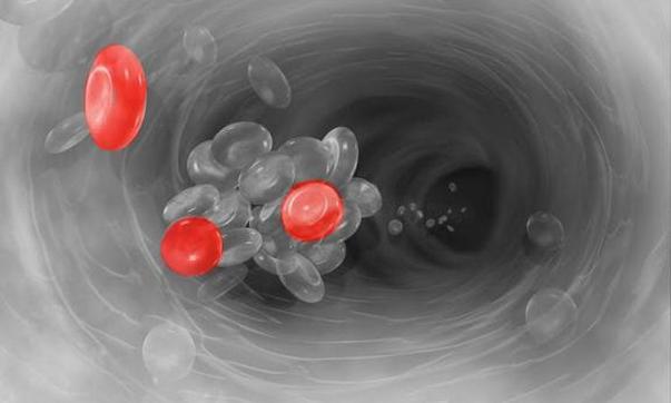 Месячные идут со сгустками крови и кусками — причины