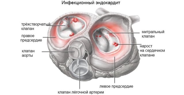 Норма лейкоцитов в крови у женщин, мужчин и детей и причины отклонений