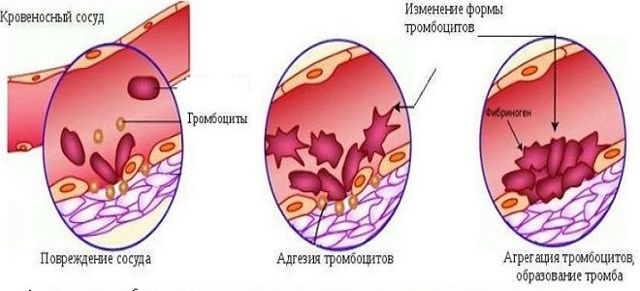 Агрегация тромбоцитов с АДФ, адреналином, ристомицином, коллагеном – норма. Что такое агрегация, гиперагрегация, гипоагрегация тромбоцитов?