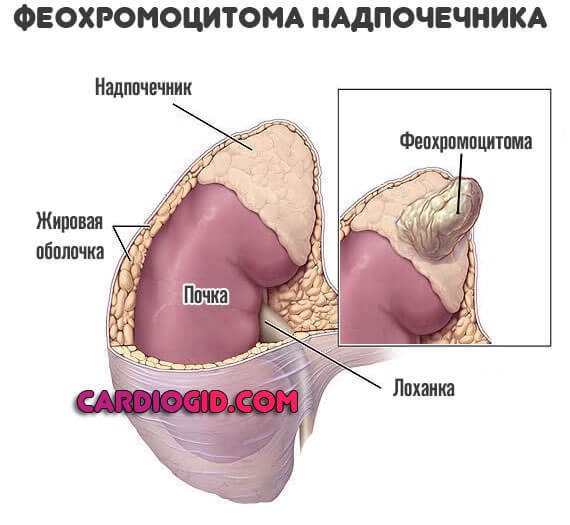 Высокое нижнее давление: причины и лечение