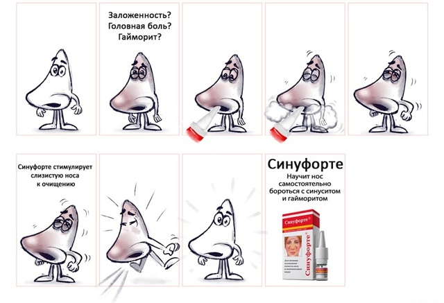 Отзывы врачей и больных о Синуфорте при гайморите: инструкция по применению