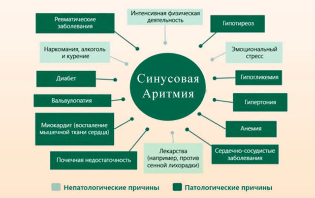 Синусовая аритмия сердца: что это такое, чем опасна, симптомы и экг