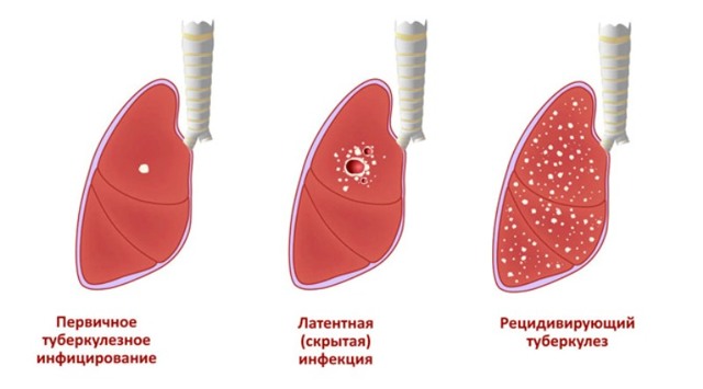 ЛИМФОЦИТЫ В КРОВИ У РЕБЕНКА ПОВЫШЕНЫ: [причины, лечение]