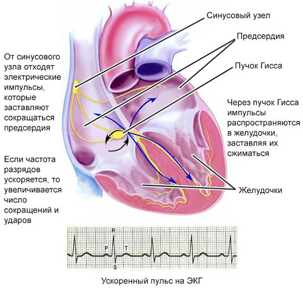 Пульс 100 ударов в минуту в состоянии покоя что делать