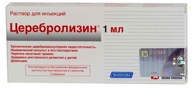Причины бессонницы после инсульта и методы терапии