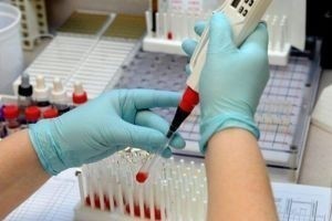 МНО анализ крови. Что это и сколько должен быть, норма, расшифровка для женщин, мужчин, при беременности. Таблица