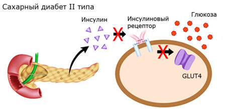 Курага чернослив при диабете 2 типа
