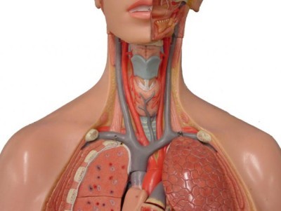 Тромб в сонной артерии: лечение, симптомы и удаление