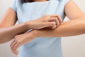 Узловатая эритема — симптомы, причины, лечение
