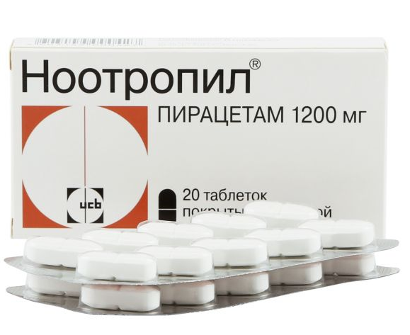 Цефалгия - причины, лечение, диагностика, классификация головной боли