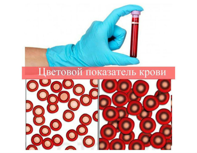 Цветовой показатель крови (ЦП)