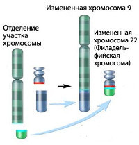 Хронический миелолейкоз: особенности болезни, лечение