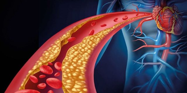 От чего происходит инфаркт миокарда