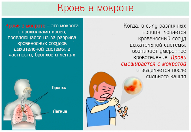 Слюна с кровью: причины ее появления при кашле, по утрам и т.д.