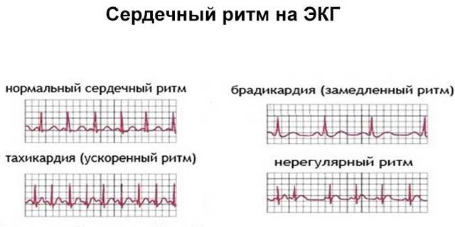 Как должно биться здоровое сердце