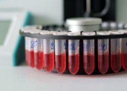 Общий (развернутый) анализ крови: что показывает, как сдавать