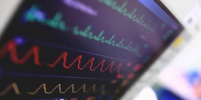 От чего происходит инфаркт миокарда