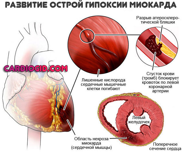 Милдронат - применение, инструкция, показания
