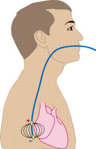 Эхо КГ сердца что это такое, как делают