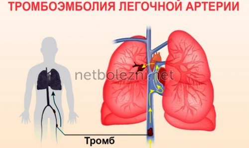 Низкое давление - причины, симптомы и признаки пониженного давления