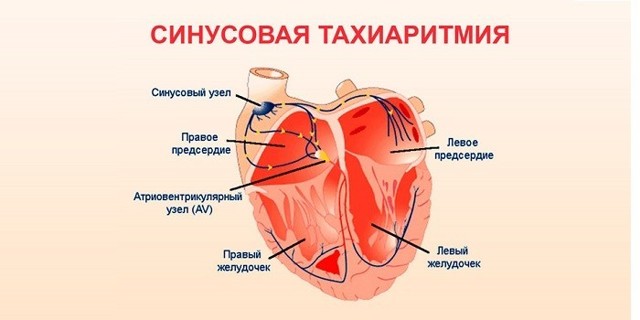 Тахикардия сердца: симптомы, диагностика и лечение - DELFI