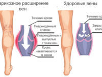 Коагулограмма - что это за анализ, как подготовиться, где сдавать, расшифровка результатов у взрослых, детей, беременных