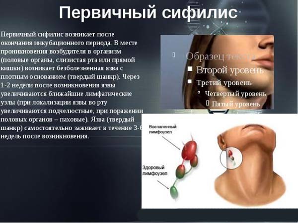 Сифилис у женщин – первые признаки, симптомы, лечение