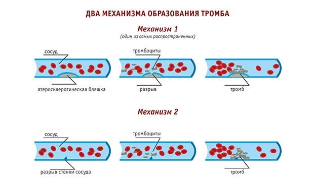 Препараты для разжижения крови, список средств и лекарств разжижающих кровь и препятствующих тромбообразованию