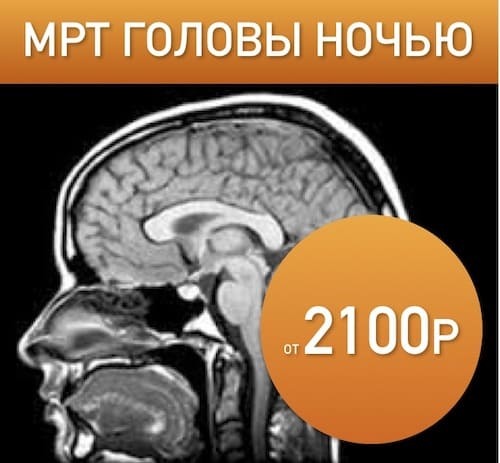 Сделать мр-венография головного мозга в Санкт-Петербурге - ICLINIC