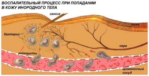 Абсолютное содержание базофилов повышено