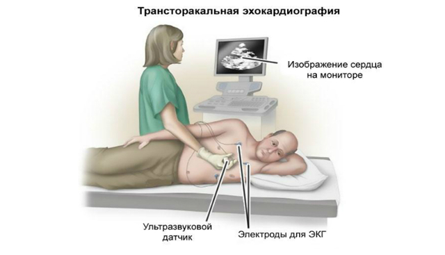 Гипоксия сердца симптомы и лечение