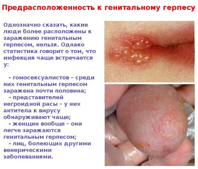 Генитальный герпес - фото проявлений у мужчин и женщин