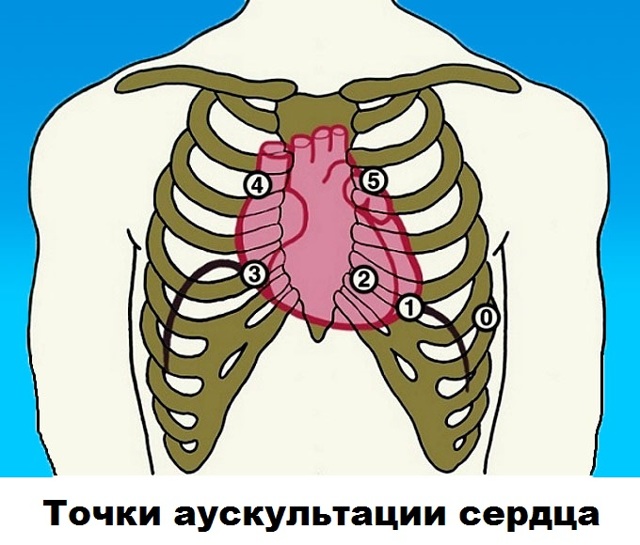 Аускультация: шумы сердца - Секреты клинической диагностики - Медицинская учебная литература